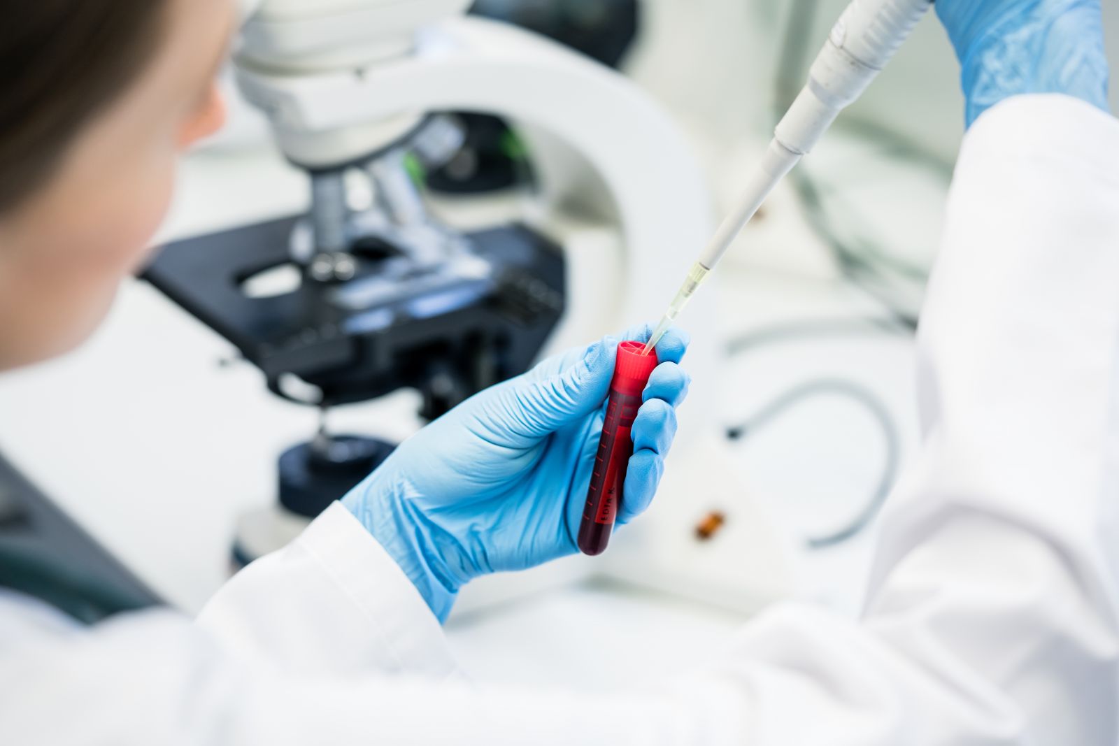 IGM Test bei unerklärbaren Unverträglichkeiten