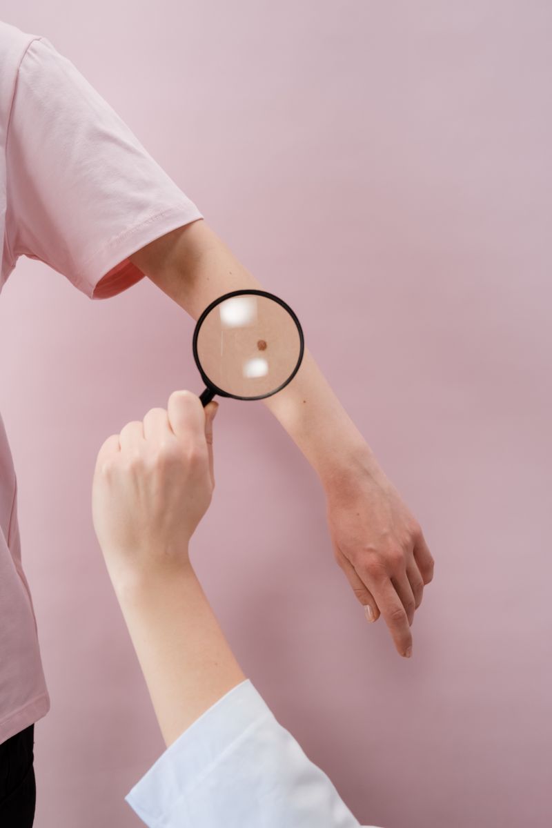 hautkrebs alternativmedizin