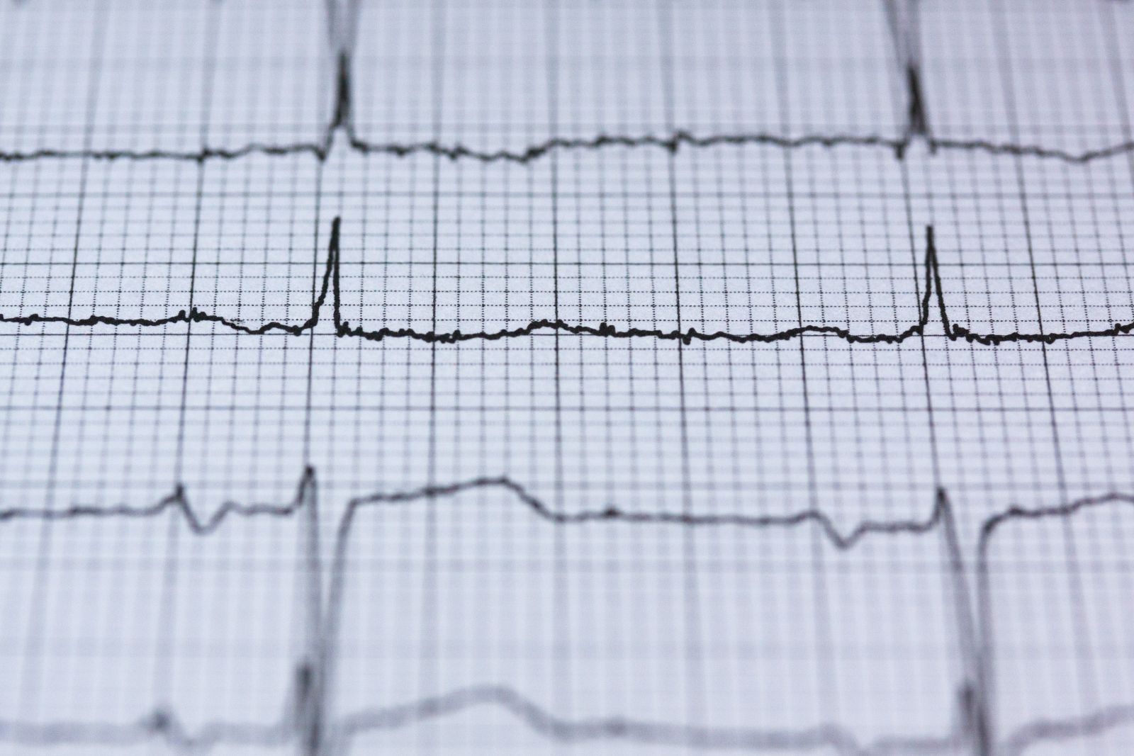 Alternativmedizin Herzrhythmusstörungen
